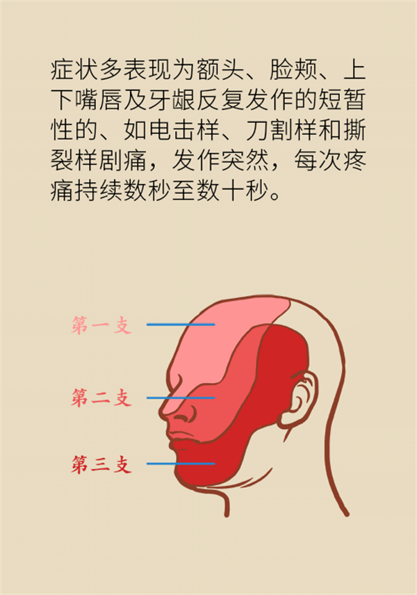 這種疼痛不是牙疼？緩解三叉神經(jīng)痛就用這兩招