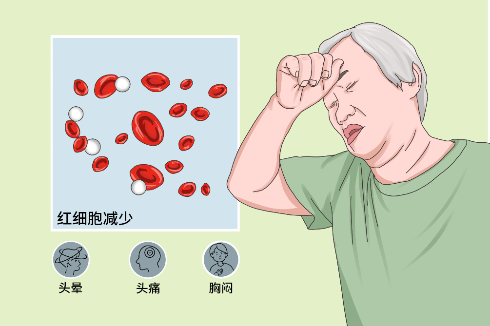 我國(guó)學(xué)者提出貧血治療新策略