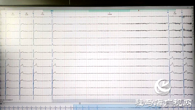 40歲中年 一夜之間心臟停搏30次最長10秒鐘 該拿什么拯救他?